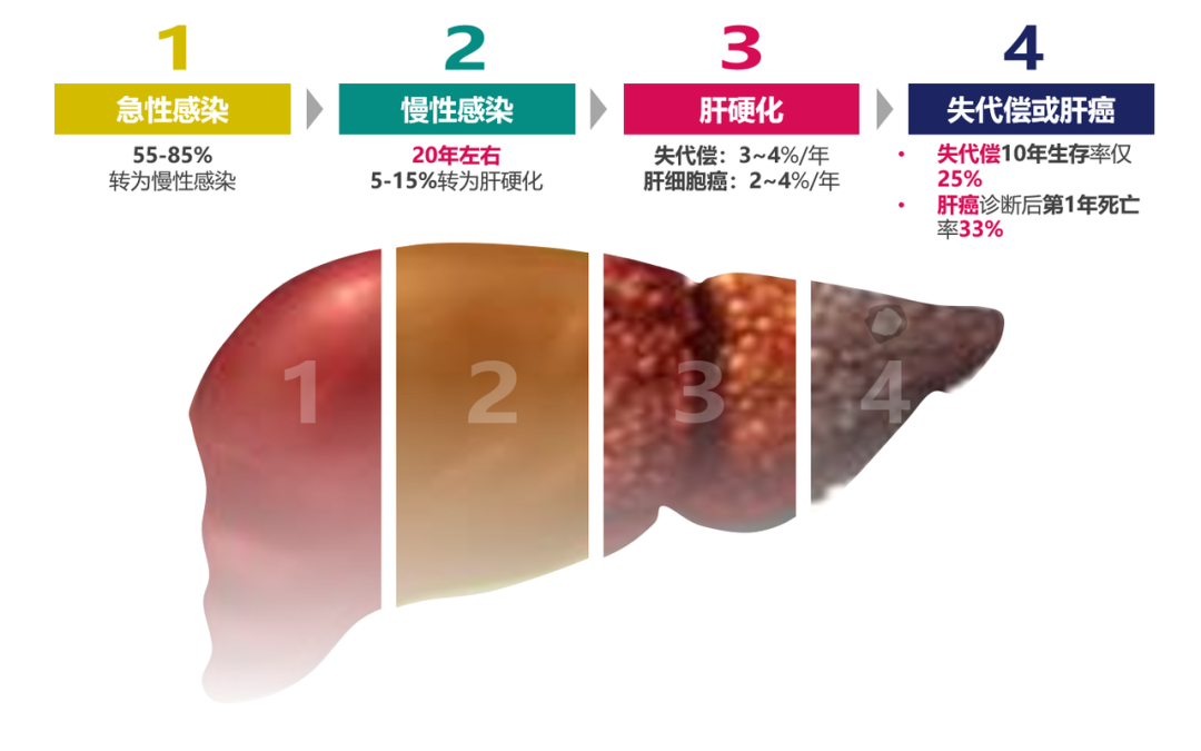 悄悄變成肝硬化、肝癌，很多人感染了卻不知道