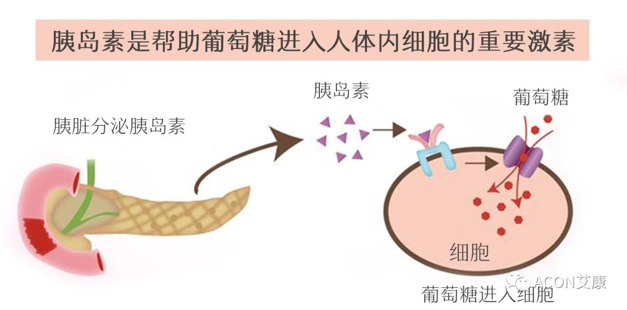 爆上熱搜，因爆發(fā)型糖尿病進(jìn)入ICU，有哪些教訓(xùn)值得我們汲取